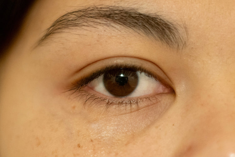 Close-up of the skin around the eye