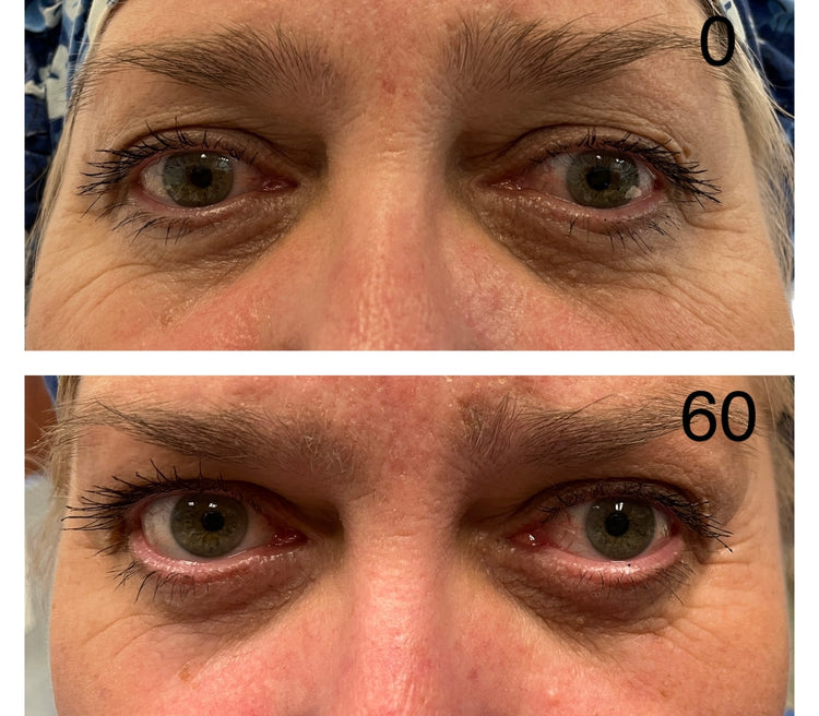Customer before and after 60 days of use