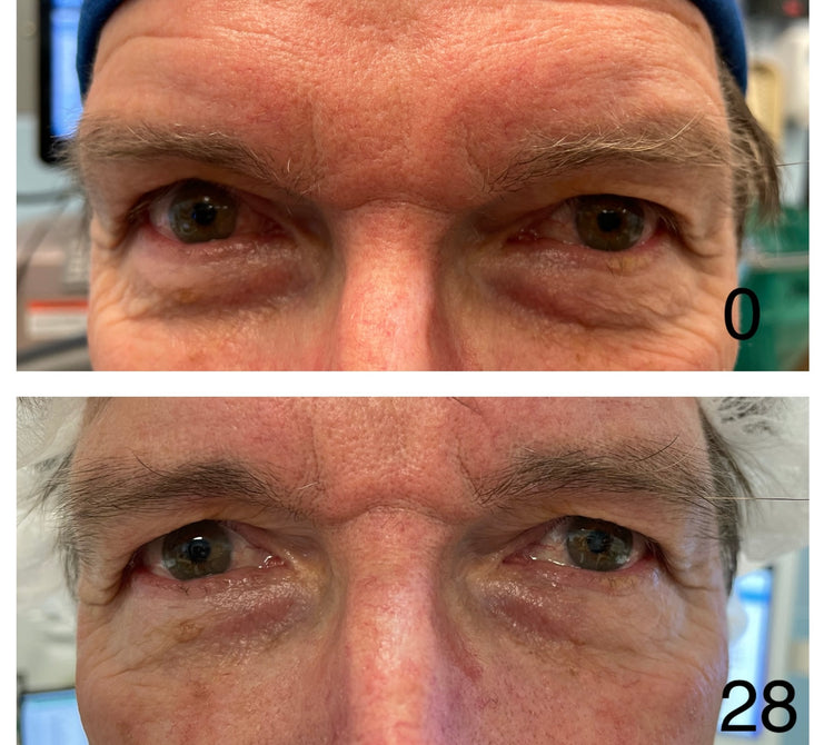 Customer before and after 28 days of use