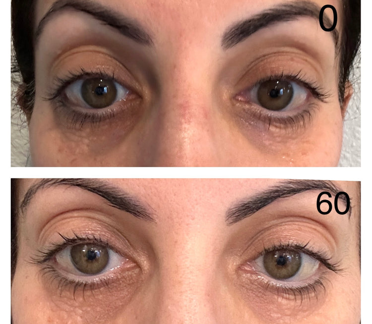 Customer before and after 60 days of use